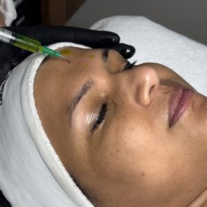 Dermapen